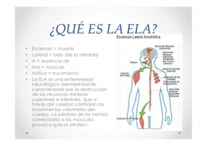 esclerosis-lateral-amiotrofica